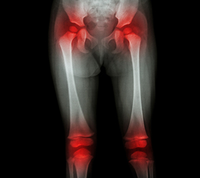 What are common causes of pain in the right hip?