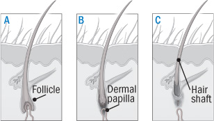 Treating Female Pattern Hair Loss Harvard Health
