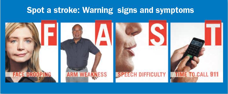 Image result for fast warning signs of stroke