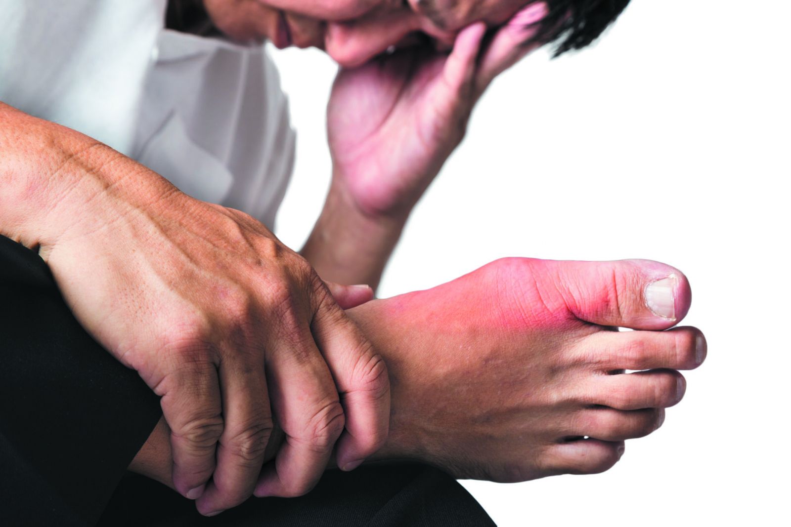 Are You At Risk For Gout Harvard Health