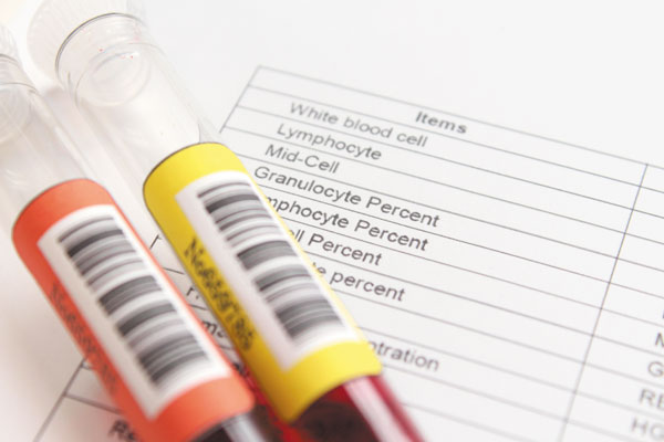 How do you know if your blood test results are normal?