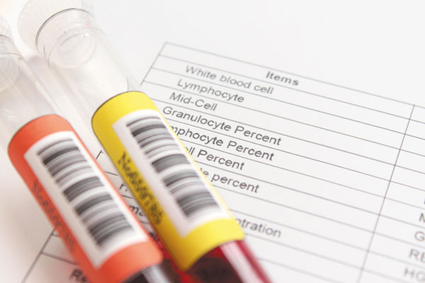 Order Of Blood Draw Chart 2016