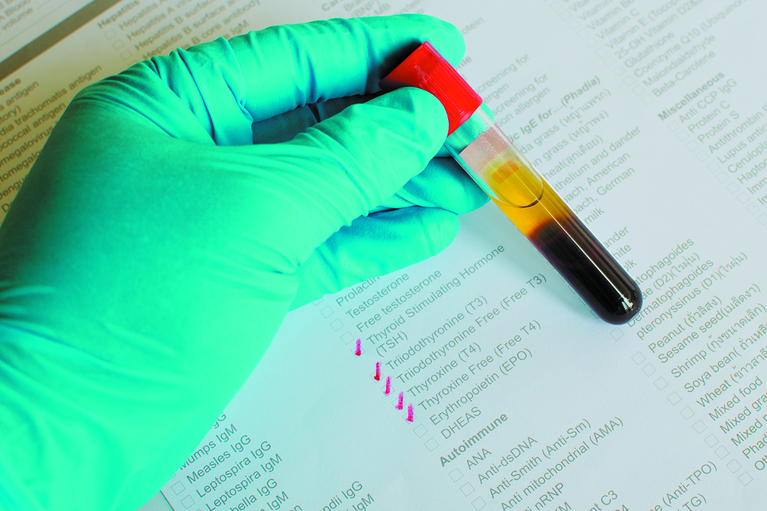 Do You Need A Thyroid Test Harvard Health