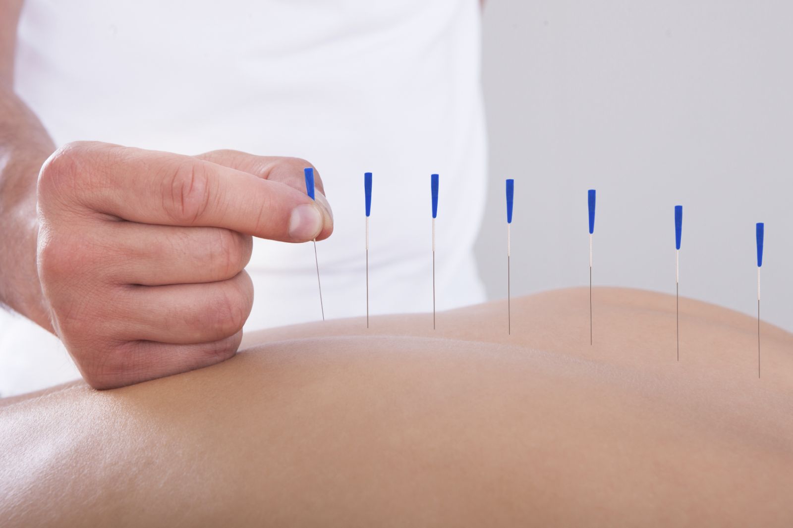 How Acupuncture Pain Treatment Works