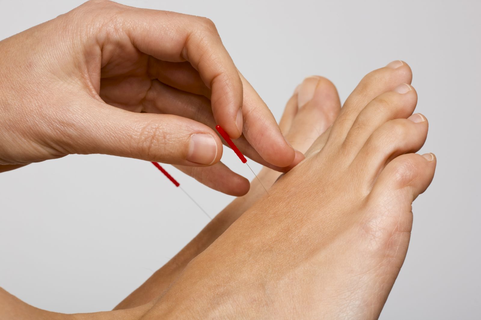 Acupuncture for rheumatoid arthritis Harvard Health