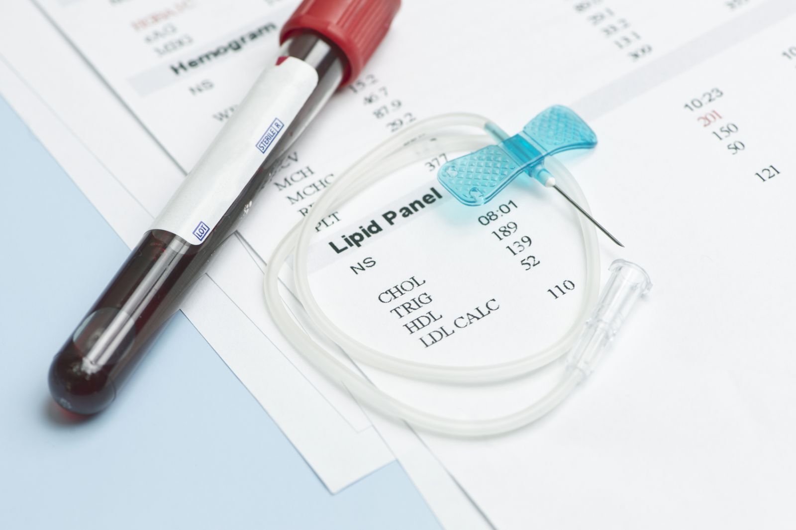 Cholesterol Lab Values Chart