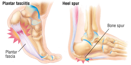 foot pain above heel below ankle