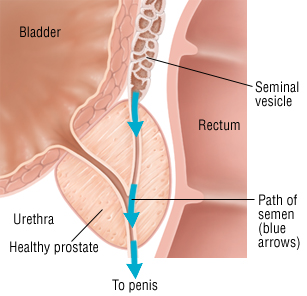 erectie retrograda