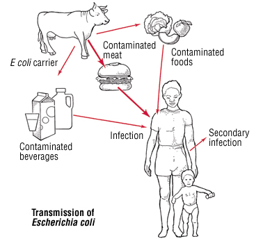 Types Of Food Poisoning Chart