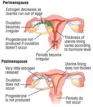 Menopause And Perimenopause Harvard Health