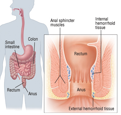 Oct 2010. Anal bleeding may be caused by haemorrhoids or anal fissures ,or serious.