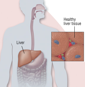 can alky hepatitis lead to stick pain