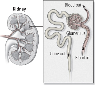 Diabetic Nephropathy Harvard Health