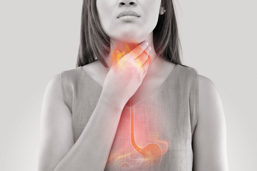 Acid reflux disease long term effects