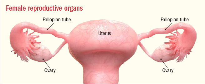 Uterine cancer kya hota hai - Ovarian cancer kaise hota hai