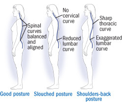 4 Ways To Turn Good Posture Into Less Back Pain Harvard Health