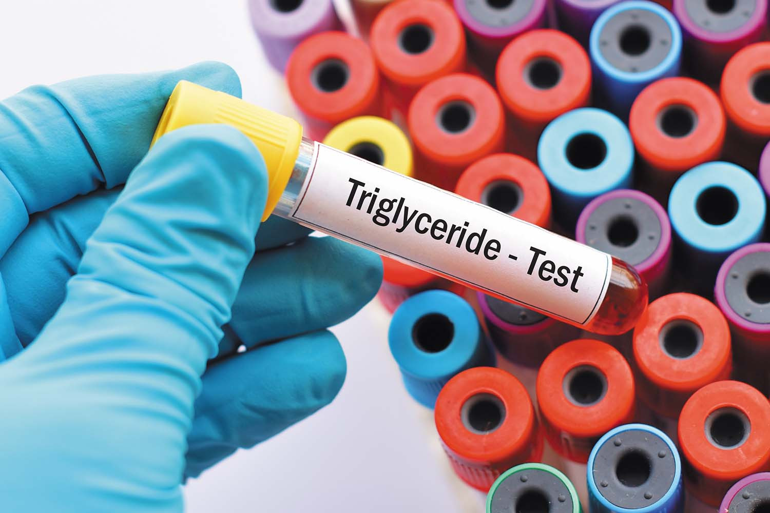 Keeping tabs on triglycerides - Harvard Health