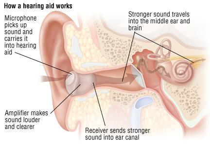 Hearing Loss In Adults Harvard Health