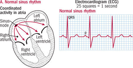 illustration of heart in normal rhythm and ECG reading