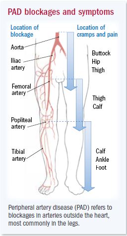 Vineland Vascular Specialist