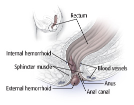 Extra skin around anus after pregnancy