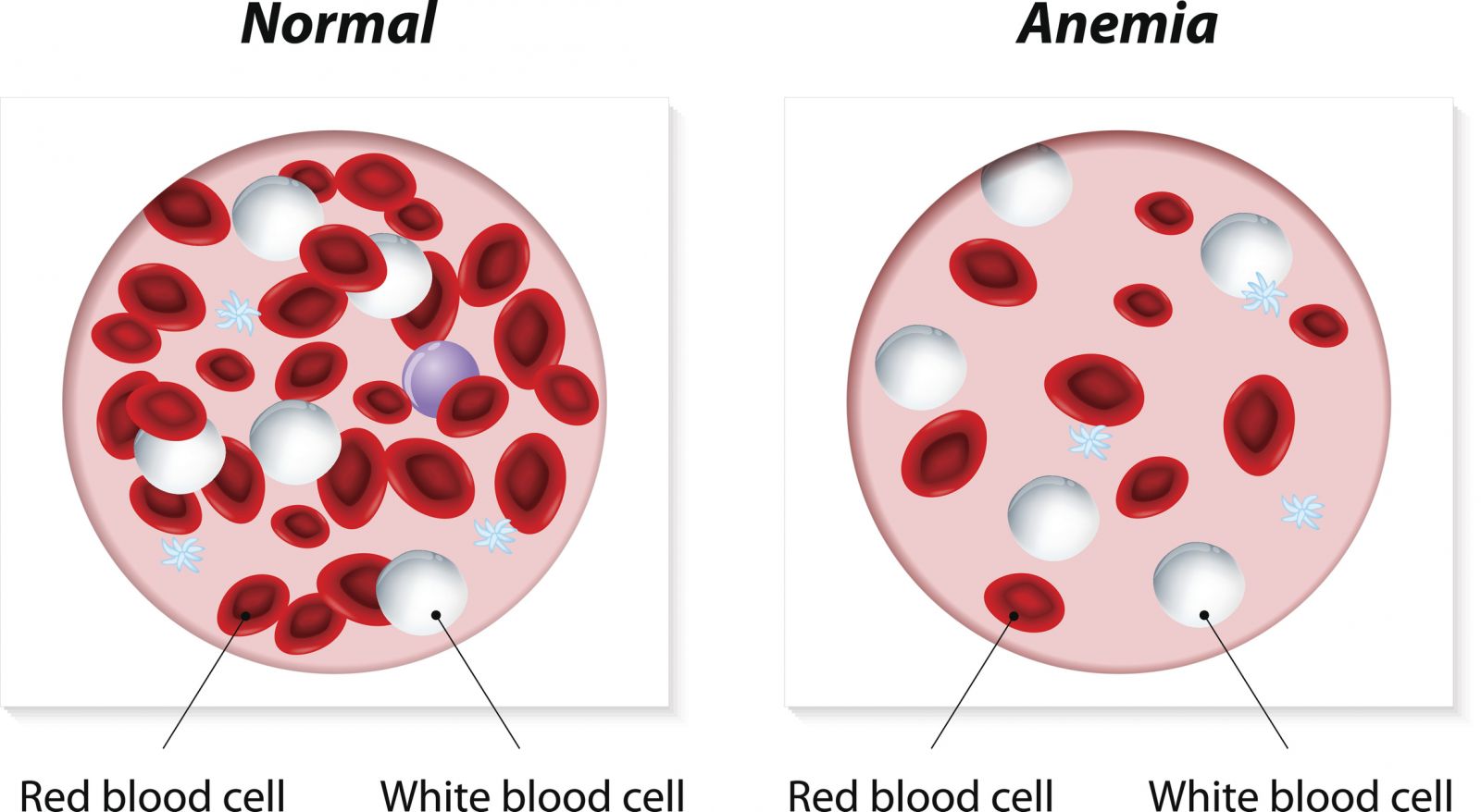 What are the side effects of low white blood cells Dangers Of High Low White Blood Cells Underlying Factors Selfhacked