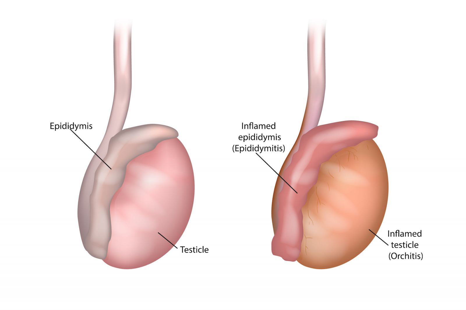 herbs for testicular atrophy