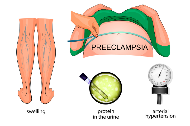 does diet affect preeclampsia
