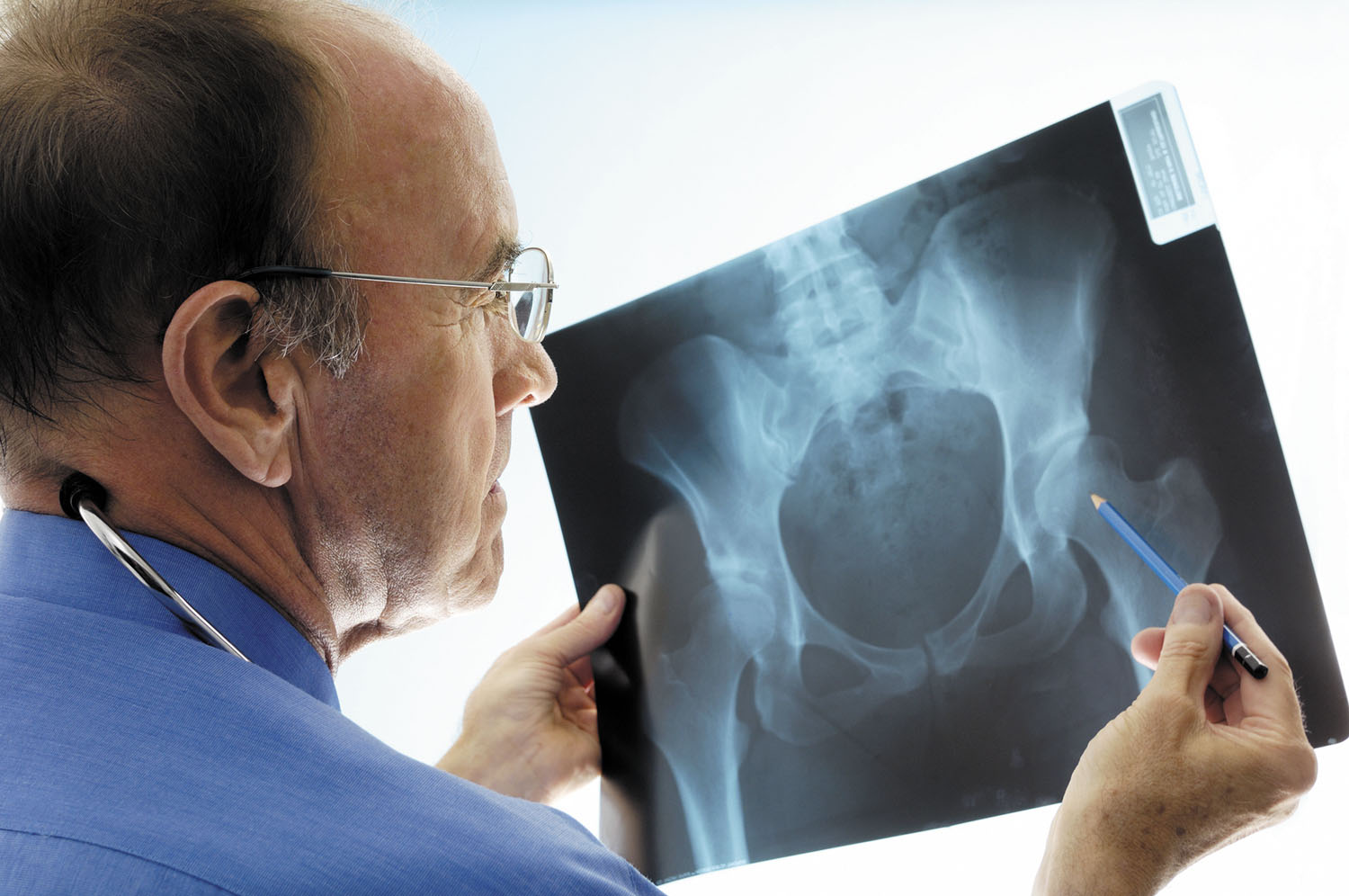 Should I Get A Bone Density Test Harvard Health the-importance-of-having-a-bone-density-test
