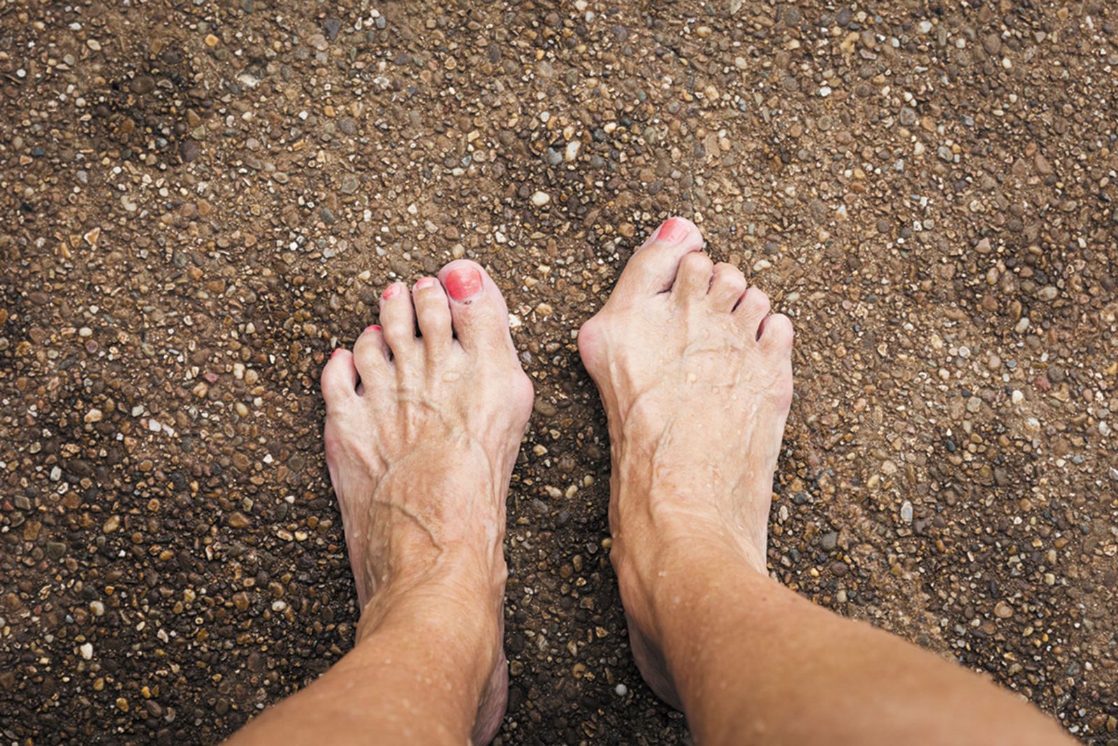 4. Bone-Inspired Toe Nail Designs - wide 1