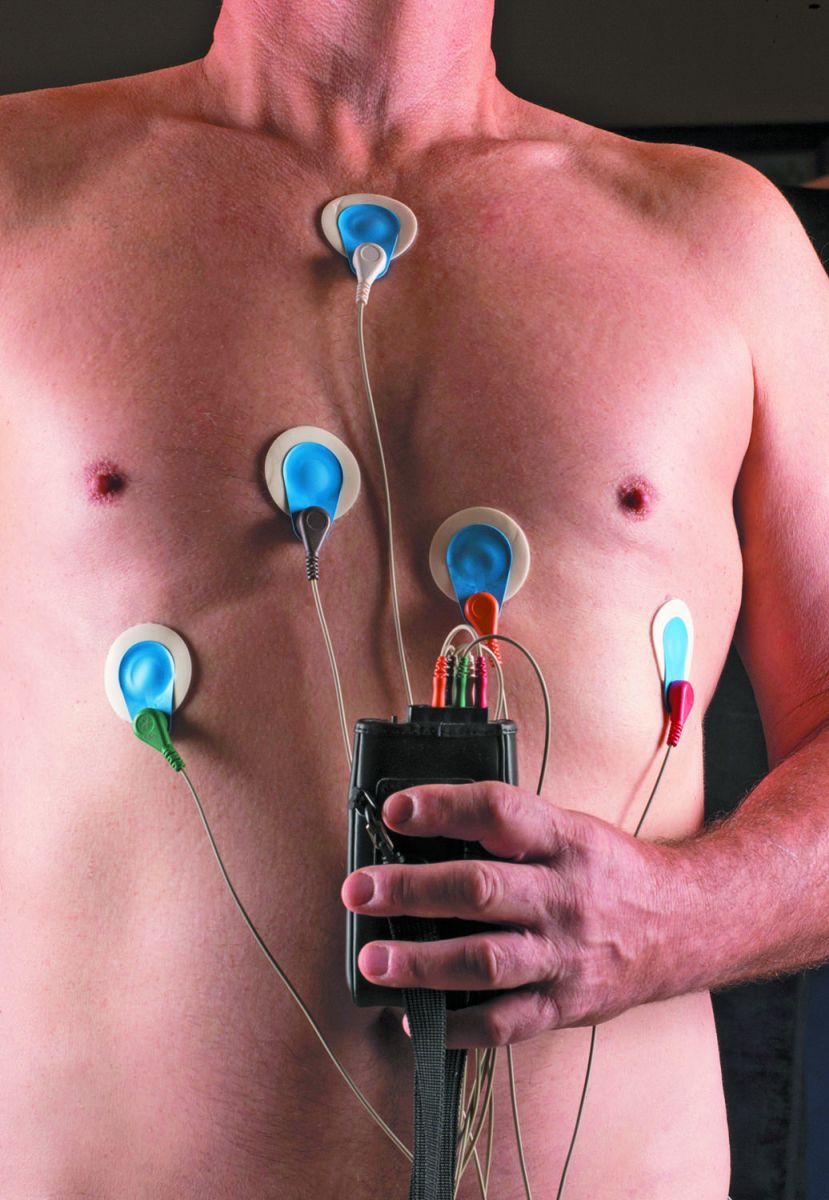 Taking A Look At The Latest Trends In Heart Rhythm Monitoring
