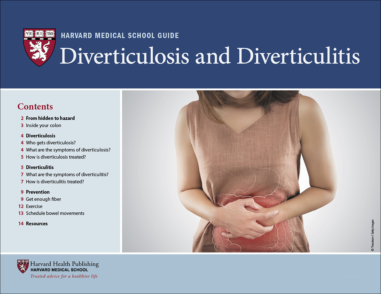Diverticulosis and Diverticulitis - Harvard Health