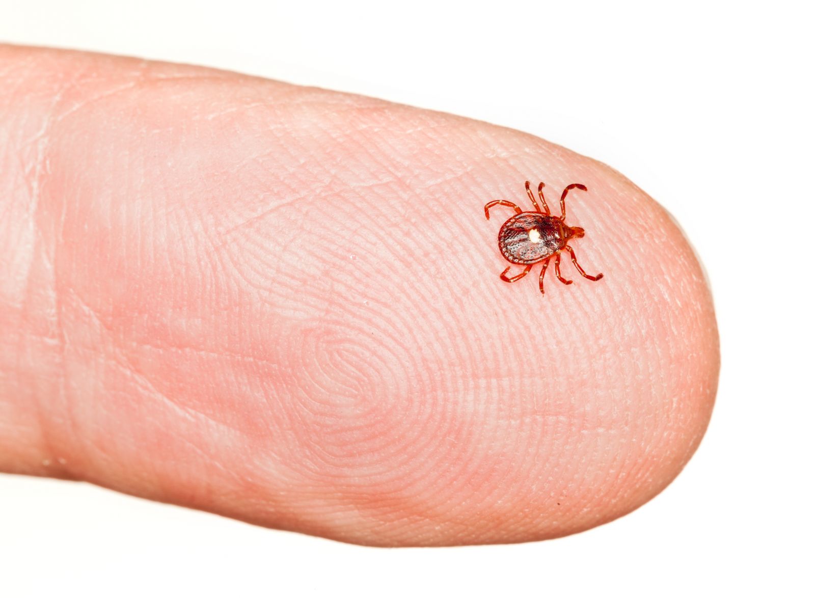 Red Meat Allergy Spread By Ticks A Link To Heart Disease