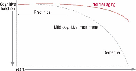 Stages Of Alzheimer S Chart