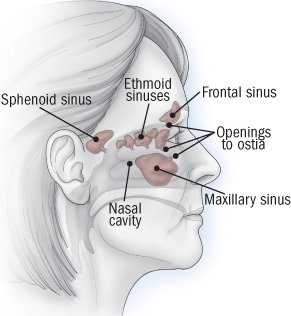 What to do about sinusitis - Harvard Health
