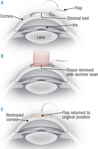 Ophthalmologist Orlando